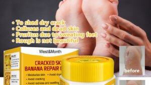 Banana Foot Repair Cream Chapped Moisturizing Care