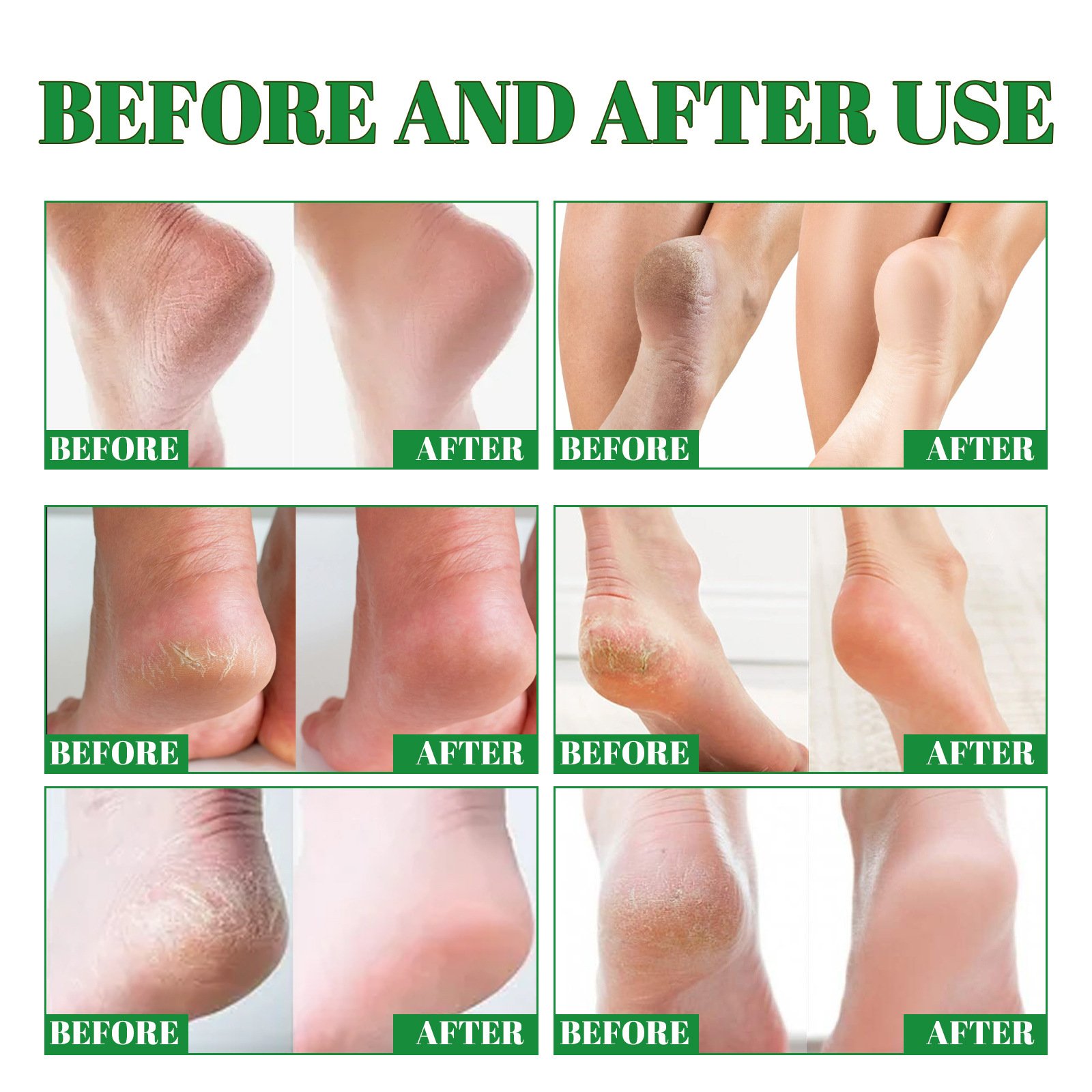 Deep Cleansing Foot Heel Moisturizing Cream - Image 5