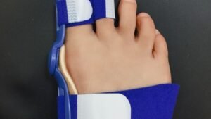 Big Foot Valgus Corrector Wear Protective Cover