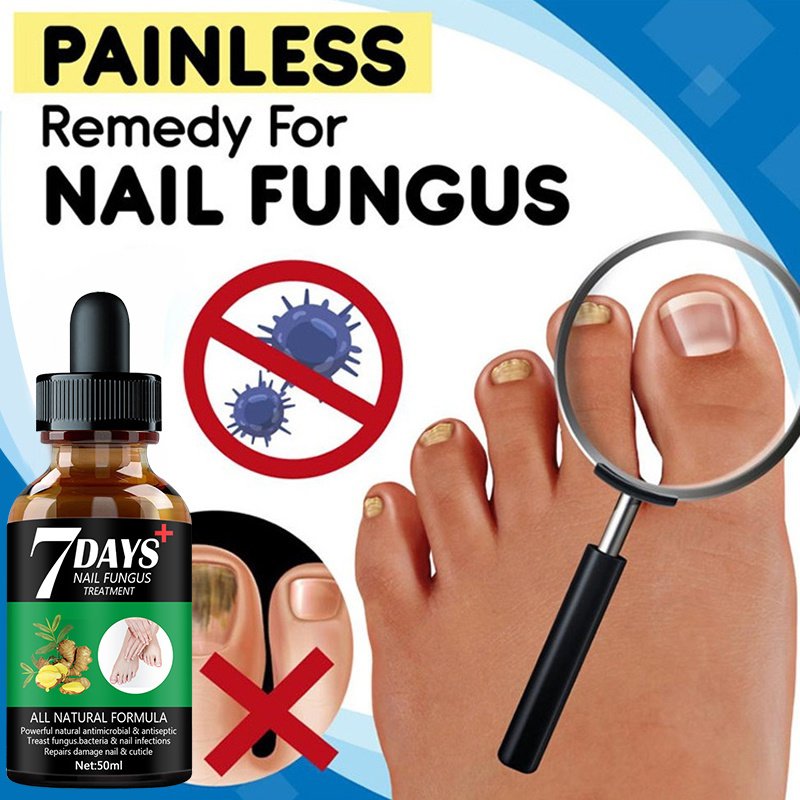 7DAYS Nail Fungus Treatment Serum Care Hand And Foot Care Removal - Image 5