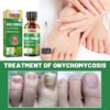 Foot Nail Tea Tree Oil Finger Thick Soft Nail Nutrition Hand And Foot Nail Care Solution