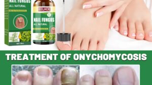 Foot Nail Tea Tree Oil Finger Thick Soft Nail Nutrition Hand And Foot Nail Care Solution