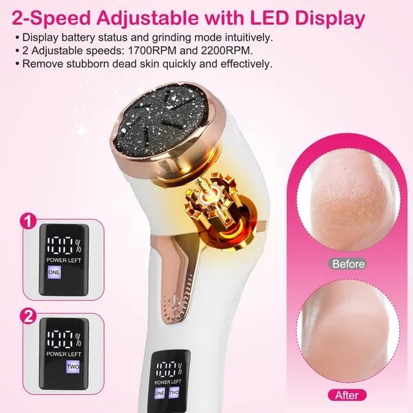 17 Pcs Electric Foot Callus Remover With Vacuum Foot Grinder Rechargeable Foot File Dead Skin Pedicure Machine - Image 3