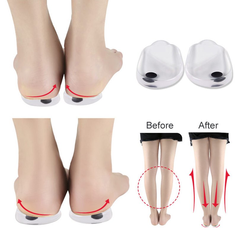 Insoles Correction Shoe Inserts Pads Effective O And X Type Leg Bowed Legs Knee Valgum Straightening For Women Men Health Care - Image 4