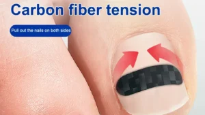 1/5Pcs Carbon Fiber Ingrown Toe Nail Ingrown Toenail Correction Tool Elastic Patch Sticker Straightening Clip Brace