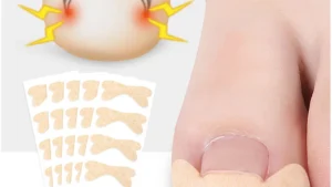 1 sheet Ingrown Toe Foot Nail Correction Sticker Pedicure Toenail Corrector