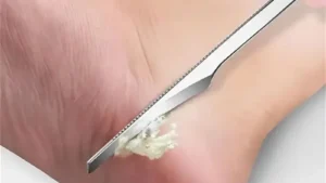 Stainless Steel Dead Skin Remover Toe Nail Shaver Foot Knife And Callus Rasp For Pedicure And Foot Care Skin Care Beauty Tool 1P