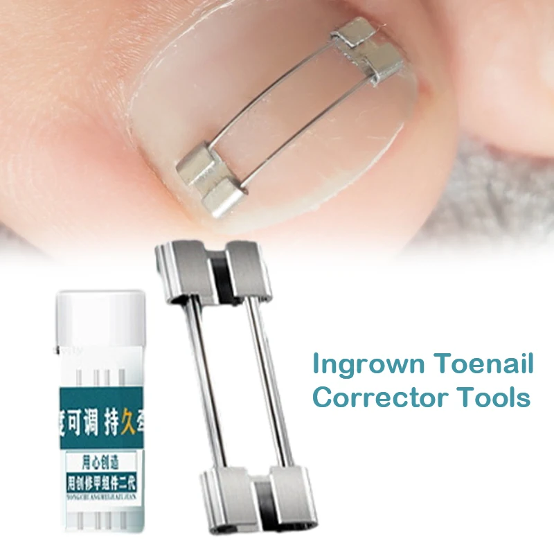 Ingrown Toenail Corrector Tools Pedicure Recover Embed Toe Nail Treatment Professional Ingrown Toenail Straightening Clip Brace - Image 6
