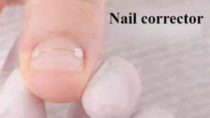 1 Pcs Nail Tools Toenail Accessory Major Corrector Titanium Alloy Reusable Wire Daily Use Convenient Compact Correction