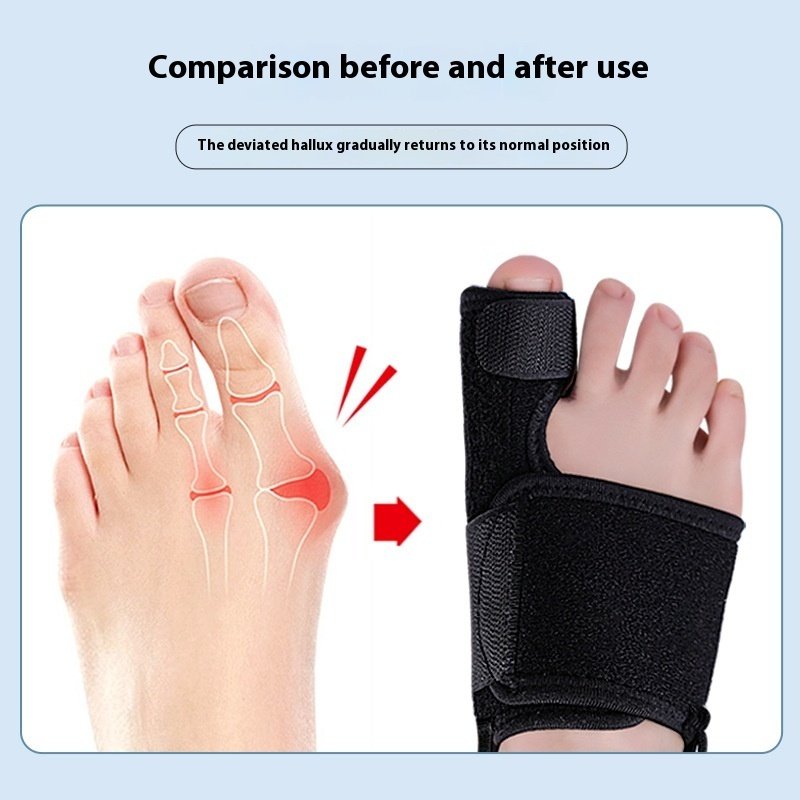 Adjustable Day And Night Use Toe Fixed Strap - Image 4