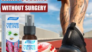 Vein Spray Relief Blood Vessel Bulge Smoothing Earthworm Leg Massage Spray