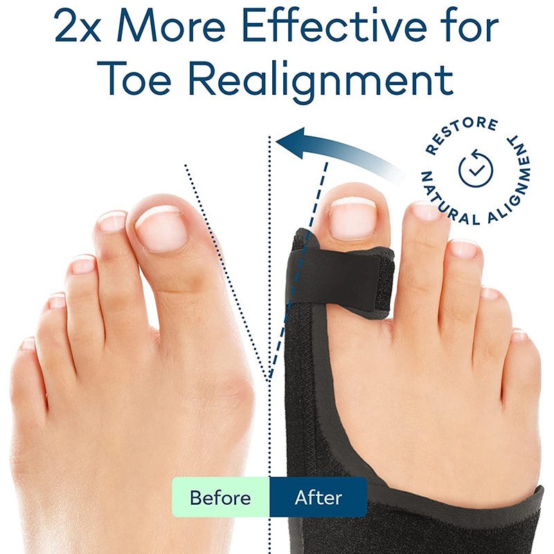Big Toe Brace Hallux Valgus Orthotics Band - Image 5