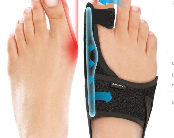 Big Toe Brace Hallux Valgus Orthotics Band - Image 8