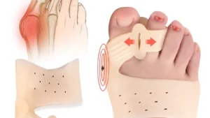 Forefoot Pad Sebs double-hole Forefoot Divider For Hallux valgus, day-night Toe Brace For Big Toe Bone Orthosis
