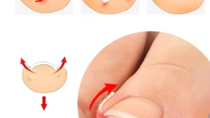 60pcs Ingrown Paronychia Toenail Corrector Strips Anti Nail Patch Feet Sleeping Nail Patch Nails Into The Flesh Long Toe Pad