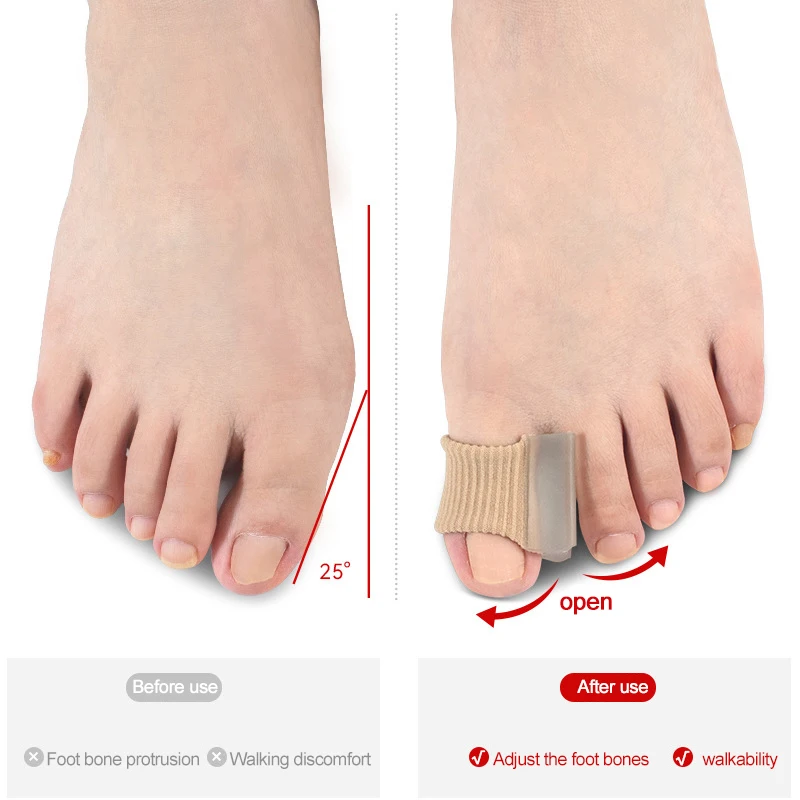1 Pcs Toe Separator Ring Separation Hallux Valgus Correction Pads Foot Care Foot Toe Hallux Valgus Correct - Image 3