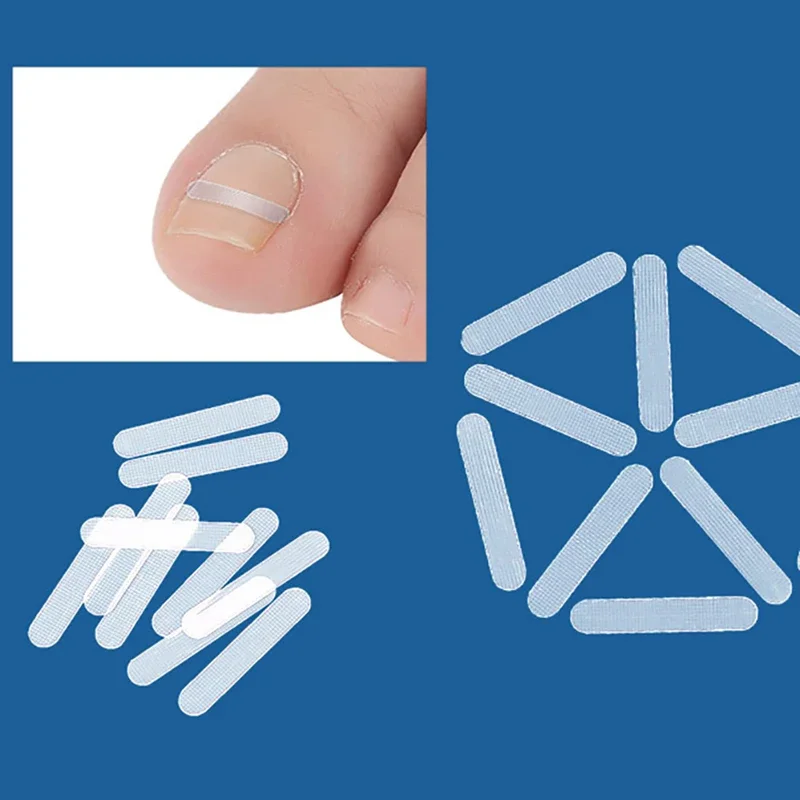 10 pcs Ingrown Toe Nail Treatment Ingrown Toenail Correction Tool Elastic Patch Sticker Straightening Clip Brace Pedicure Tools - Image 3