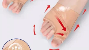 1pair Big Toe Separator Bunion Corrector Hallux Valgus Correction Device Bone Thumb Orthopedic Forefoot Pad Foot Straightener