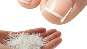 Ingrown Toenail Correction Tool Nail Filling Pad Ingrown Toe Nail Treatment Elastic Patch Straightening Clip Brace Pedicure Tool